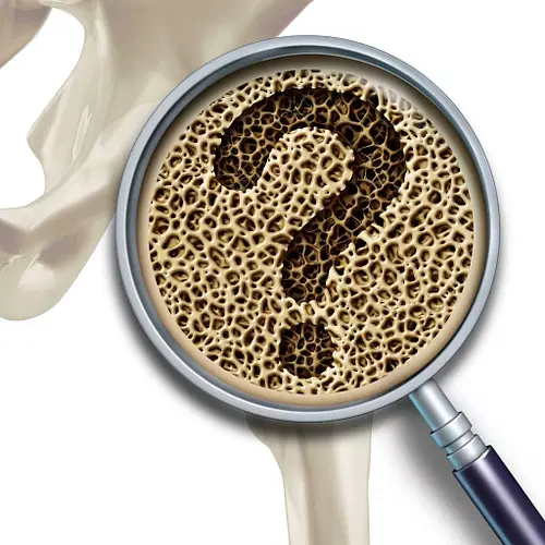 Representación de salud osteoarticular y ejercicio